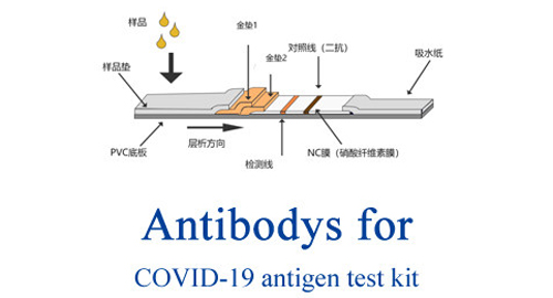 항체 COVID-19 항원 시험